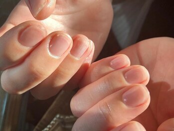 ネイルカフェ ナナ(nailcafe'nana)の写真/ささくれ・爪のごわつき・かみ癖等のダメージケアに◎指周りは一番使う部分だからこそ本気の徹底ケア！