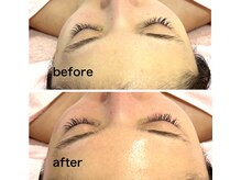 アニッシュ(ANISH)/WiQo水光ピール/ピーリング/ツヤ