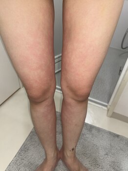 ヨサパークワイエス 用賀(YOSA PARK ys)/あまみが出ます!!