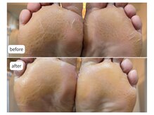 カシェット(Cachette)/50代女性◎足裏角質ケア90分