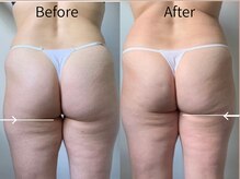 アムール 麻布十番(Amour)の雰囲気（最新エンダモロジーでサイズダウンだけでなく肌質たるみケアも◎）