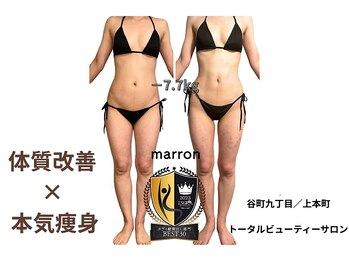 マロン(marron)の写真/二の腕から背中のハミ肉迄詰まったリンパを流して徹底分解！痩身マシン×筋膜リリースで美しいシルエットに