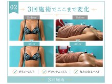 ネイト ワックス(Neit Wax)/３回でここまで変化◎
