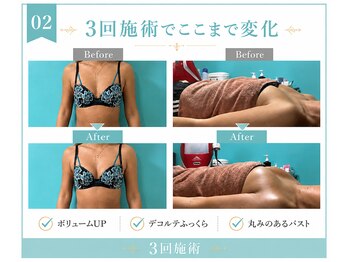 ネイト ワックス(Neit Wax)/3回でここまで変化◎