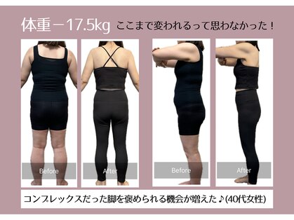 アネモネの写真