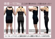 アネモネ