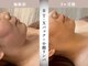 モルティー 小山店(Molti)の写真/【たるみ小じわ・肌ハリ改善サロン】ハリと弾力を取り戻すBT-Xパックが凄い!将来のたるみ予防にも効果的◎