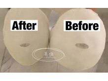 美極 トータルビューティー(美極 TOTAL BEAUTY)/恵比寿/小顔コルギ/エステ/