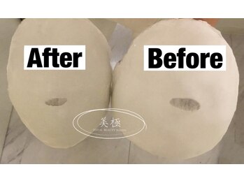 美極 トータルビューティー(美極 TOTAL BEAUTY)/恵比寿/小顔コルギ/エステ/