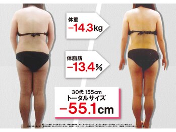 セントラヴィ 横浜西口店/Before After【30代女性(2)】