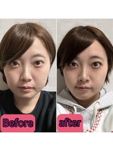 ノウ(nou)/小顔矯正／ヘッドスパ