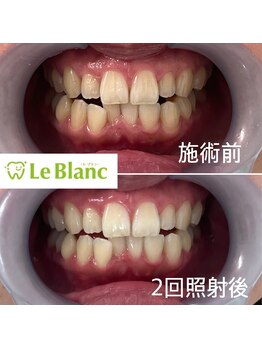 ルブラン 奈良店(Le Blanc)/いつまでも美しく♪