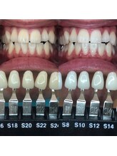トウキョースワーズ 渋谷店(TOKYO SWRS)/#ホワイトニング #渋谷 #池袋