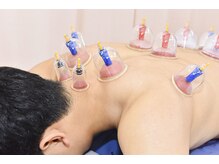 深谷接骨院/カッピングによるリンパケア