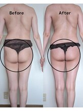 サロン ド ベルメール(Salon de Belle mer)/リンパマッサージ/痩身/リンパ