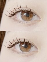 ミイプ(MEPP)/まつだ担当・フラットラッシュ