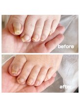 コトリ(Kotori)/【爪ケア】