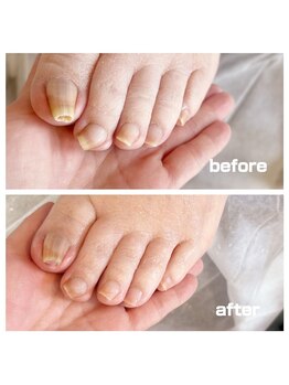 コトリ(Kotori)/【爪ケア】