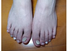 イーズ(ease)/フット　シルバーピンク