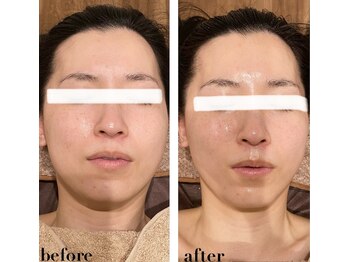 エヌ セレクション(N_selection)/ボンバークリーム×美筋小顔