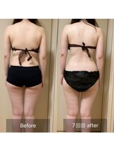 ココカラ(COCOKARA)/インディバ/アロマ　痩せ