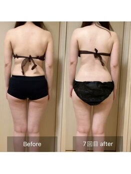 ココカラ(COCOKARA)/インディバ/アロマ　痩せ