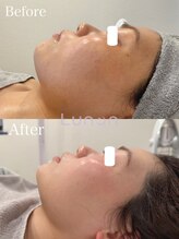 ルノン(Lunon)/ララピール