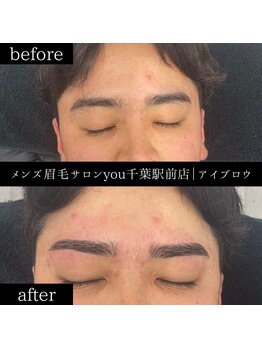 ユー 千葉駅前店(you)/ビフォ－アフター写真