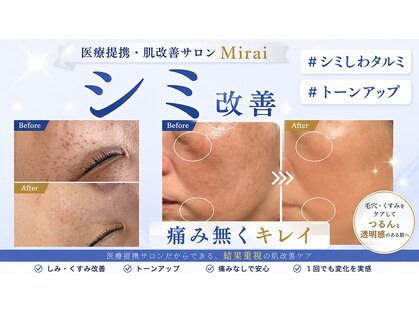 ミライ(Mirai)の写真