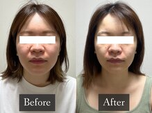 ベルフィーヌ 恵比寿店(BELFINE)/回数を重ねるごとにより美しく