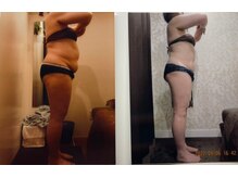 パーフェクトボディプレミアム 札幌駅前店(PERFECT BODY PREMIUM)/お客様　ビフォーアフター（10）