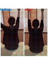 春日部コアラ整体院/Before→After（肩の外転）
