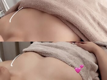 シア(Shia)/嬉しい副産物♪リフトアップ小顔