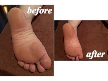 モア(MORE)/フットケア