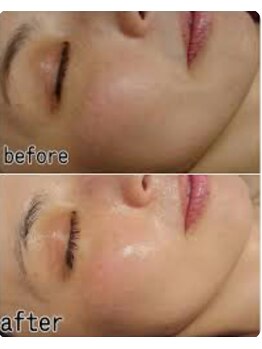 クリスタルハート(Crystal heart)/