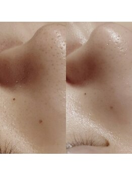 マイフェアレディ 今池(MyFairLady)/人気No.1韓国肌管理