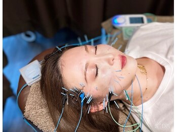 鍼灸院 満月/美容鍼で左右差撃退！！