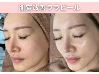 BUB 立川/韓国発ララピール