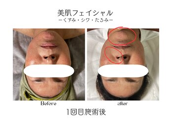 サロン デ ニコ(Salon de NIKO)/美肌光フェイシャル