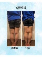 コア カイロプラクティック 錦糸町/ビフォーアフター　錦糸町/亀戸