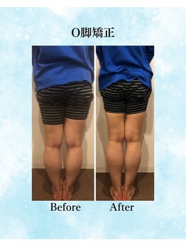 コア カイロプラクティック 錦糸町/ビフォーアフター 錦糸町/亀戸