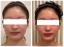 美人バスト 浜松店/最強小顔★コルギ/フェイシャル!