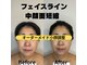 リル(LIL)の写真