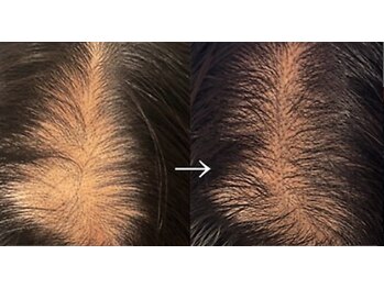 タカイ(TAKAI)の写真/【極上リラックス×本格育毛】心地よい水流導入とソフトな頭蓋骨整体で、頭皮の疲れと髪の悩みを解消★