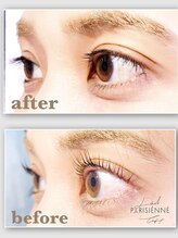 エール(Ale)/パリジェンヌ　before/after