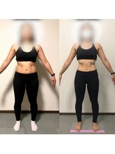 インペリアルボディ(Imperial Body)/Before After 30代女性　Y様