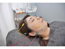 ここのはりきゅう治療院/美容鍼