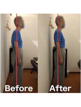 カワル整体 上通り院/【肩こりと頭痛の関係】