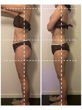 ベルミナ(Belmina)/大名/天神/毛穴/脱毛/痩身