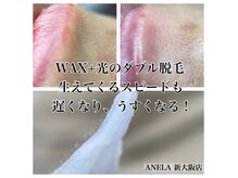 アネラ(ANELA)の雰囲気（ダブル脱毛でスピード卒業。産毛まで逃がしません）